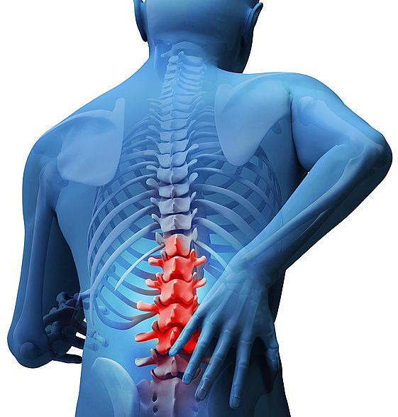 Fisioterapia Heredia - Lumbalgia: más que un dolor de espalda